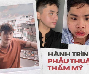 Hành trình lột xác ngoạn mục của chàng trai chi 200 triệu cho 5 lần 'dao kéo', nhiều lần phải đấu tranh '1 là đẹp hơn, 2 là chết'