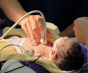 Bé sơ sinh 1 ngày tuổi bị bệnh tim bẩm sinh phức tạp, bác sĩ phải phá vách liên nhĩ để cứu sống bé
