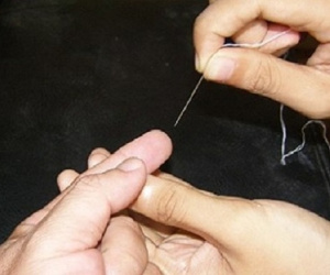 Tại sao tuyệt đối không nên chích máu đầu ngón tay để sơ cứu nạn nhân đột quỵ