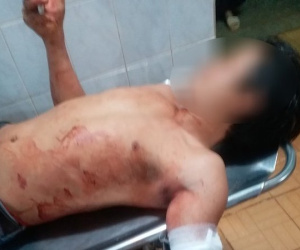 Vác rựa truy sát hàng xóm vì mở nhạc quá to