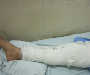 Bị tai nạn gãy xương sườn, người đàn ông bất ngờ tử vong sau khi uống thuốc điều trị