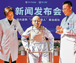 Người đàn ông mắc chứng bệnh lạ, suốt 28 năm bị gập người không thể ngẩng lên nhìn mặt ai