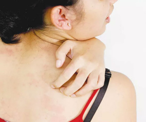 Trời hanh khô cộng thêm ô nhiễm, cách đơn giản cắt cơn ngứa da mùa đông