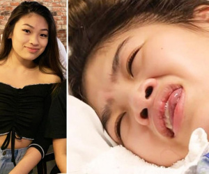 Cô gái gốc Việt sống thực vật sau ca phẫu thuật nâng ngực ở Mỹ