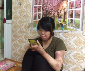 Hành trình tìm lại cuộc sống của người phụ nữ bị chồng tẩm xăng đốt