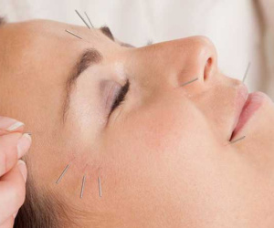 Bệnh dễ gặp mùa đông: Bỗng dưng ngủ dậy mặt bị biến dạng