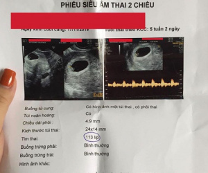 Phẫn nộ khi nhận được giấy siêu âm thai của chồng với vợ cũ, cô gái đăng đàn chia sẻ lại nhận được ý kiến gây sốc thế này