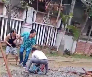 Chó Pitbull tuột xích, hung tợn cắn người đi đường nát tay