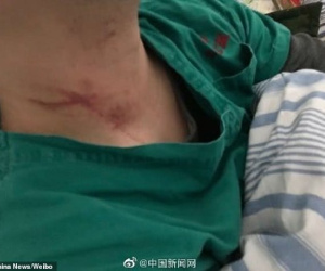 Bác sĩ Trung Quốc bị người nhà bệnh nhân coronavirus đánh đập, xé đồ bảo hộ