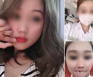 Cắn hướng dương ngày Tết, cô gái trẻ bị... rụng cả răng cửa tốn thêm bạc triệu để làm mới