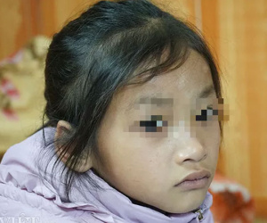 Mẹ tử nạn khi dắt con ăn xin trên cầu Thanh Trì: Bé gái 7 tuổi bây giờ ra sao?