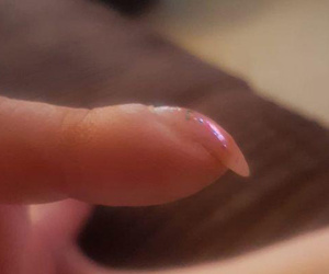Nếu ngón tay xuất hiện những dấu hiệu này, cảnh giác ngay vì có thể bạn mắc ung thư phổi