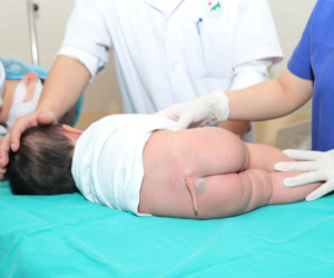 Kỳ lạ bé gái 5 tháng tuối ở Hà Nội có chiếc đuôi dài gần 10cm