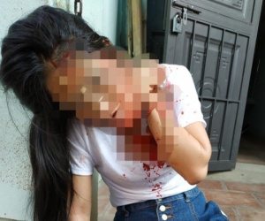 Cụ ông 74 tuổi đâm trọng thương con gái riêng của vợ 'hờ'