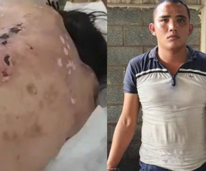 Chuỗi ngày kinh hoàng trong quán cà phê kích dục của nữ tiếp viên bị đánh thương tật 96%