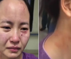 Nữ y tá bật khóc nức nở với gương mặt trầy xước, dính máu khi bị bệnh nhân nhiễm Covid-19 trong khu cách ly tấn công, từ chối điều trị