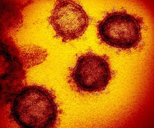 Covid-19 chưa dứt, giới khoa học lại phát hiện thêm 6 chủng virus corona ở dơi