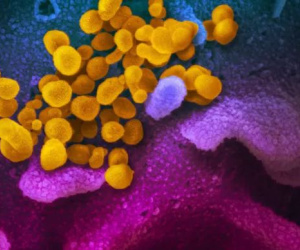 Nghiên cứu mới cảnh báo virus SARS-CoV-2 tấn công hệ miễn dịch như HIV