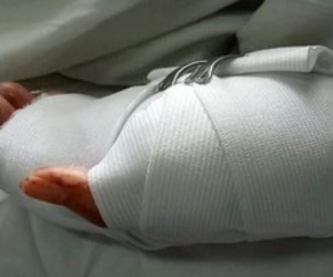 Bị nhóm thanh niên xông vào nhà chém rớt 2 ngón tay