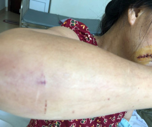 'Phi công trẻ' dùng mã tấu chém gục người tình rồi kéo ra giữa sân lột đồ