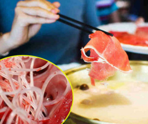 Người đàn ông phát hiện 700 con giun 'làm tổ' trong não, bác sĩ cảnh báo những loại thực phẩm quen thuộc chứa nhiều giun sán bậc nhất