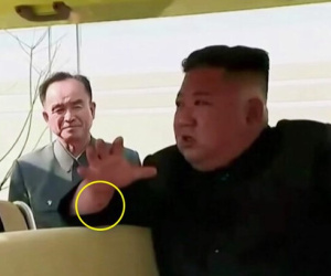 Vết đỏ gây đồn đoán trên cổ tay Kim Jong-un trong ngày tái xuất