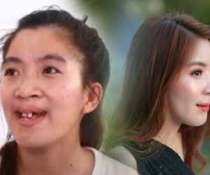 Cô gái hàm ếch bị trêu là đứa không môi 'lột xác' xinh đẹp và giọt nước mắt của người cha tần tảo khiến nhiều người xúc động