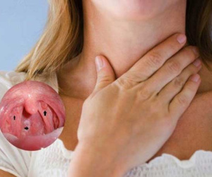 3 chị em bị ung thư vòm họng, bác sĩ cảnh báo thực phẩm nhiều người thích