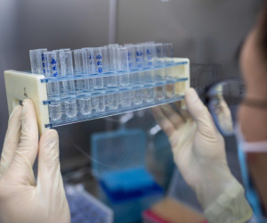 Phát hiện 'họ hàng gần gũi' của virus SARS-CoV-2 trên loài dơi