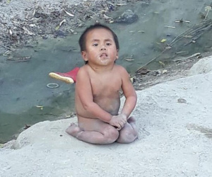 Hình ảnh mới nhất của em bé Mường Lát liệt hai chân co ro giữa giá rét sau 3 năm được nhận nuôi