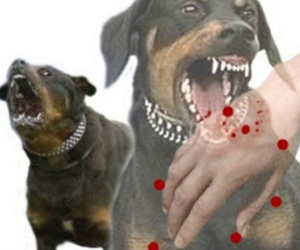 Nghệ An: Chó phát bệnh dại cắn liên tiếp 2 cháu nhỏ