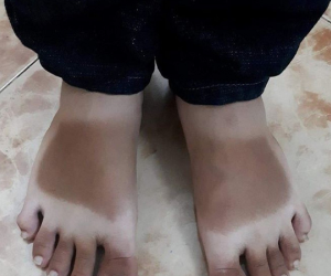 Bộ sưu tập 'áo da' rằn ri của hội hay ra đường mà không che chắn vào mùa nắng đỉnh điểm khiến ai cũng phải bất ngờ
