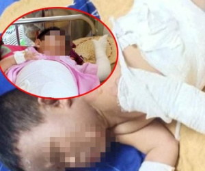 Bắt 5 đối tượng phóng hoả khiến 2 trẻ bỏng nặng