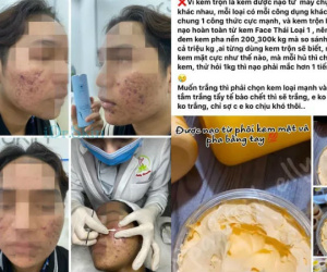 Sự thật đáng sợ trong 'thế giới kem trộn': Kinh hãi và ám ảnh!