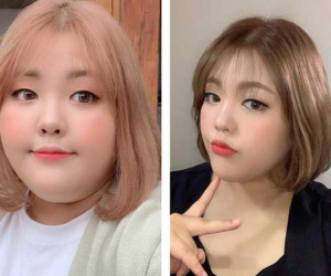 Căn bệnh ung thư phát hiện sau khi giảm cân của thánh ăn Hàn Quốc