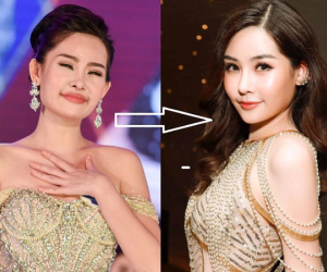 Qua chặng đường 3 năm với nhan sắc 'lên bổng xuống trầm', Lê Âu Ngân Anh từng gây ồn ào với đôi môi tều bây giờ ra sao?