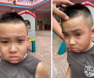 Thấy con đi mẫu giáo bị bạn cấu xước mí mắt, phụ huynh đến tận trường tát thẳng mặt trẻ trước mặt cô giáo khiến dân tình phẫn nộ
