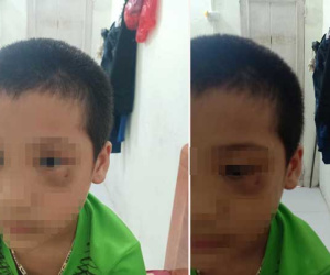 Vụ phụ huynh tát trẻ mẫu giáo: Người mẹ chính thức xin lỗi, công khai luôn ảnh đôi mắt bầm tím của con mình