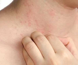 Xuất hiện 4 dấu hiệu này ai cũng chủ quan nhưng cần thải độc gan sớm, đặc biệt trong ngày hè nắng nóng