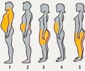 Vị trí béo tiết lộ lý do tích mỡ của bạn