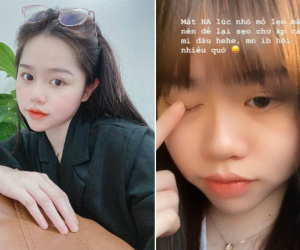 Nói chung là vẫn chưa hết bị soi, bạn gái Quang Hải vừa lý giải vì sao có đôi mắt trông như cắt mí