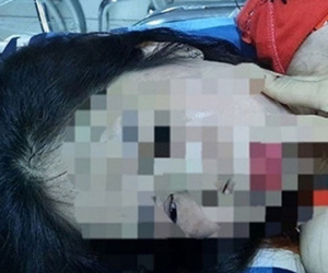 Điều tra người phụ nữ nghi bị chồng hờ bạo hành dã man