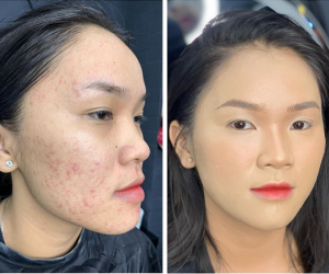 Cô nàng chia sẻ bí quyết đánh nền che mụn rỗ hiệu quả, 'đánh lừa thị giác' người nhìn