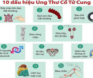 Nhận biết ung thư cổ tử cung giai đoạn sớm