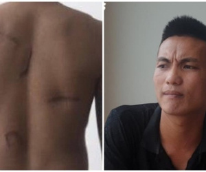 Khởi tố vụ án đàn em Đường 'Nhuệ' chém nam thanh niên sau 8 năm 'chìm xuồng'