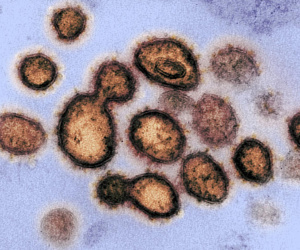 Nghiên cứu gây sốc: Phát hiện dấu vết virus SARS-CoV-2 từ tháng 03/2019