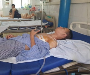 Nam sinh mới ra trường kể giây phút tông xe vào kẻ cướp tiệm vàng, bị đâm trọng thương
