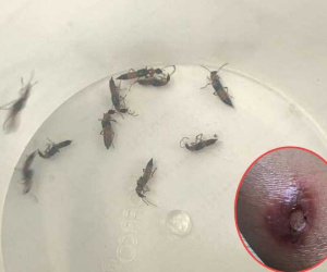 Sinh viên, mẹ bỉm sữa khiếp sợ vì bị kiến ba khoang 'khủng bố' tận giường, làm lở loét da nặng nề