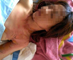 Người phụ nữ tự phóng hỏa rồi dựng chuyện bị cướp 500 triệu đồng