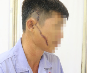 Ảnh bìa bài viết 689346
